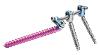 © Ulrich Medical. Todos los derechos reservados. Queda prohibido el uso, la reproducción o la distribución sin autorización expresa.