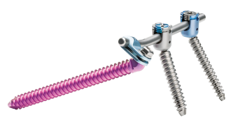 © Ulrich Medical. Todos los derechos reservados. Queda prohibido el uso, la reproducción o la distribución sin autorización expresa.