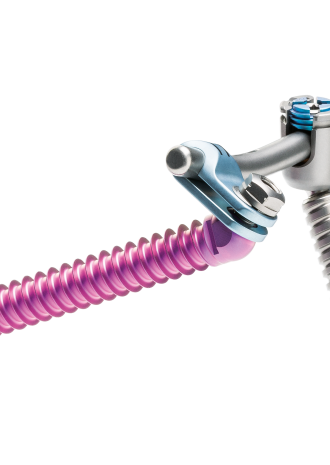© Ulrich Medical. Todos los derechos reservados. Queda prohibido el uso, la reproducción o la distribución sin autorización expresa.