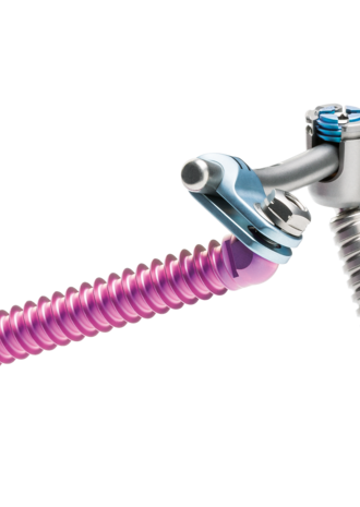 © Ulrich Medical. Todos los derechos reservados. Queda prohibido el uso, la reproducción o la distribución sin autorización expresa.