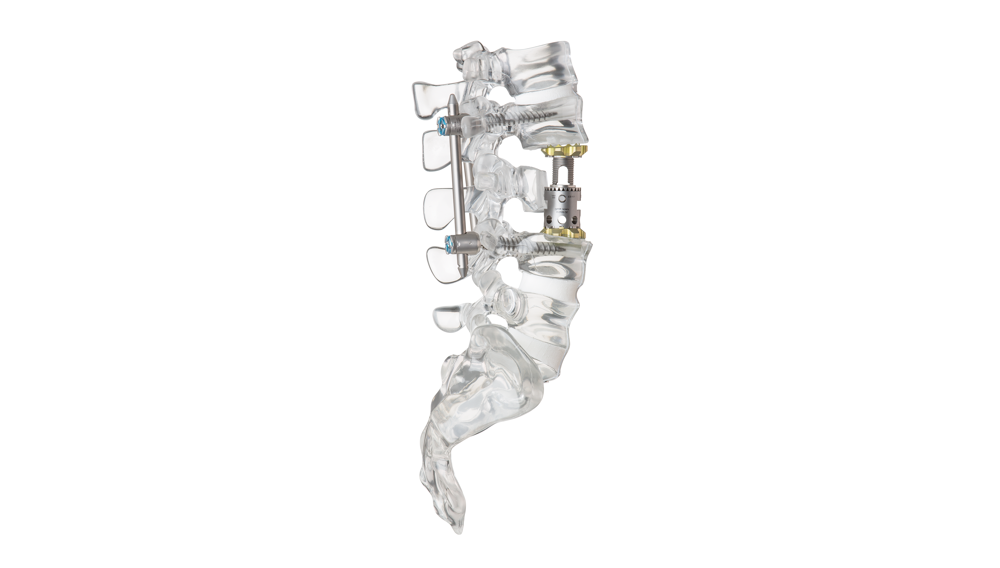 © ulrich medical. All rights reserved. Use, reproduction or transfer without express authorization is not permitted.