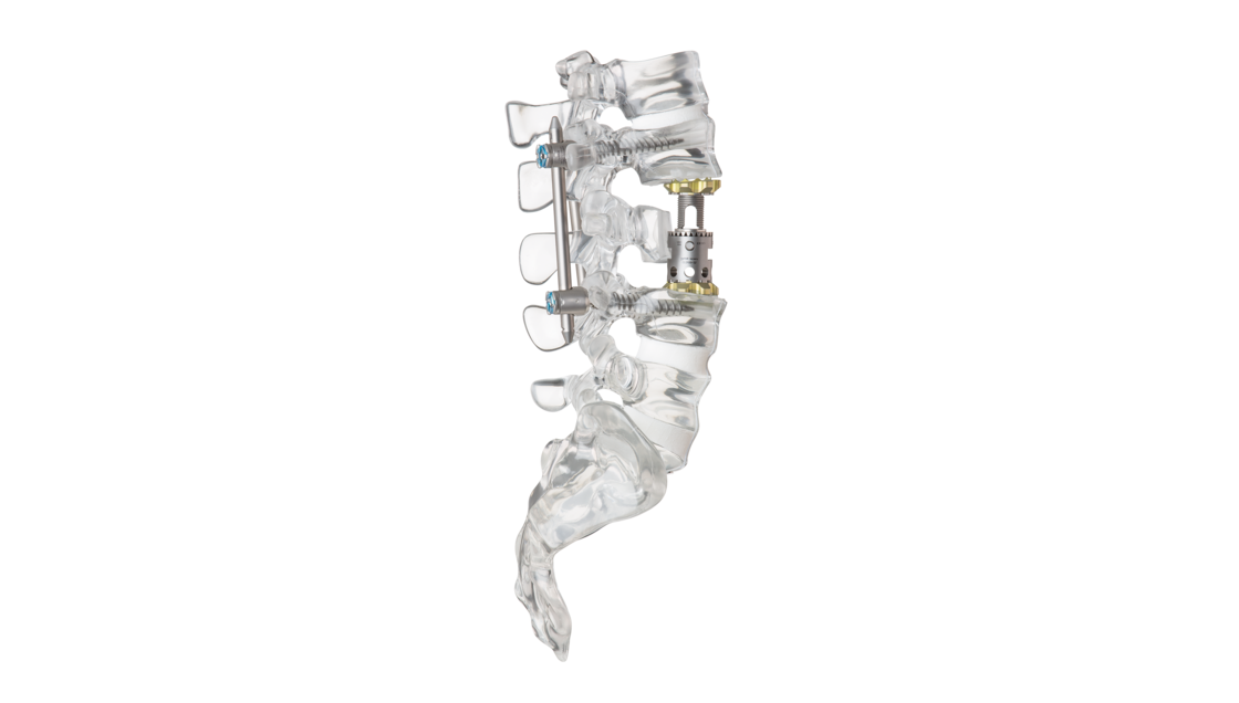 © ulrich medical. Tous droits réservés. L'utilisation, la reproduction ou la transmission sans autorisation expresse est interdite.