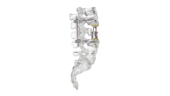 © ulrich medical. Tous droits réservés. L'utilisation, la reproduction ou la transmission sans autorisation expresse est interdite.