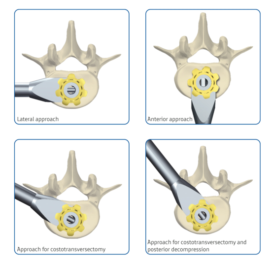 © ulrich medical. All rights reserved. Use, reproduction or transfer without express authorization is not permitted.