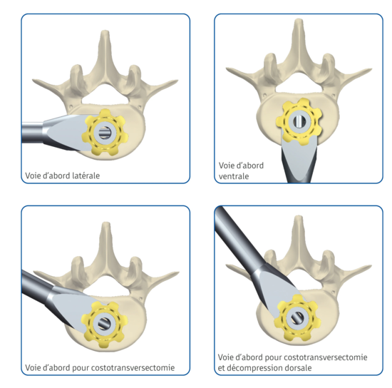 © ulrich medical. Tous droits réservés. L'utilisation, la reproduction ou la transmission sans autorisation expresse est interdite.