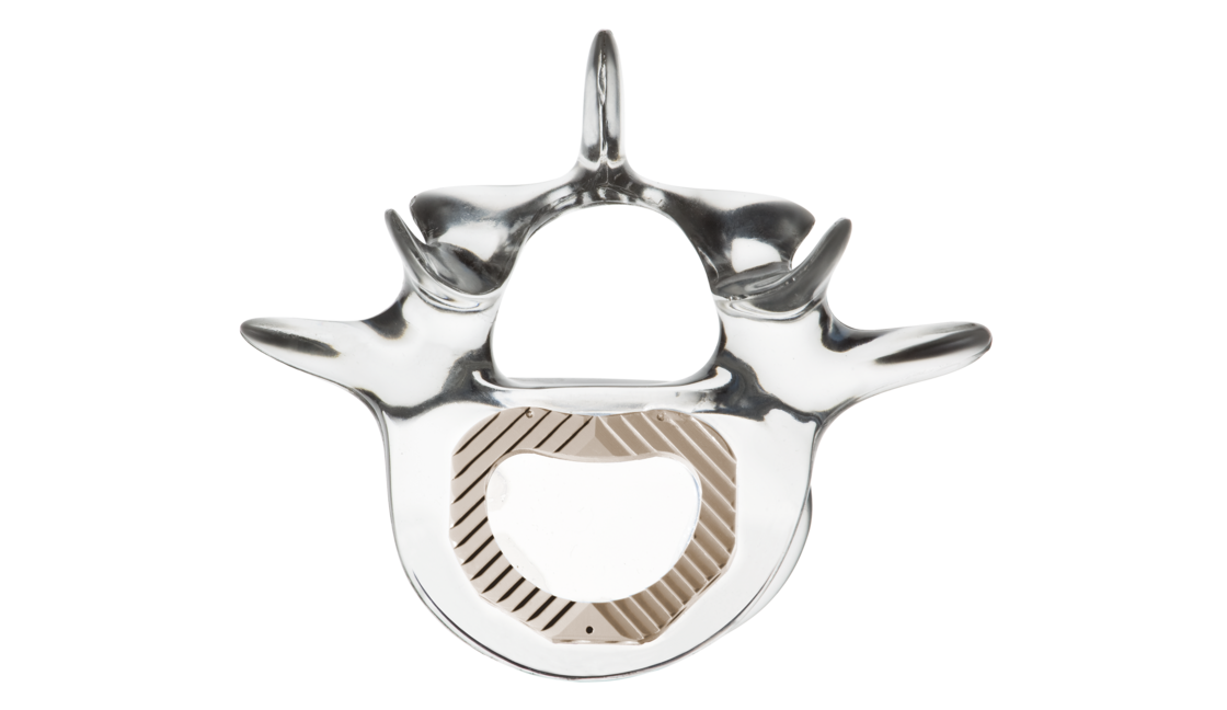 © ulrich medical. All rights reserved. Use, reproduction or transfer without express authorization is not permitted.