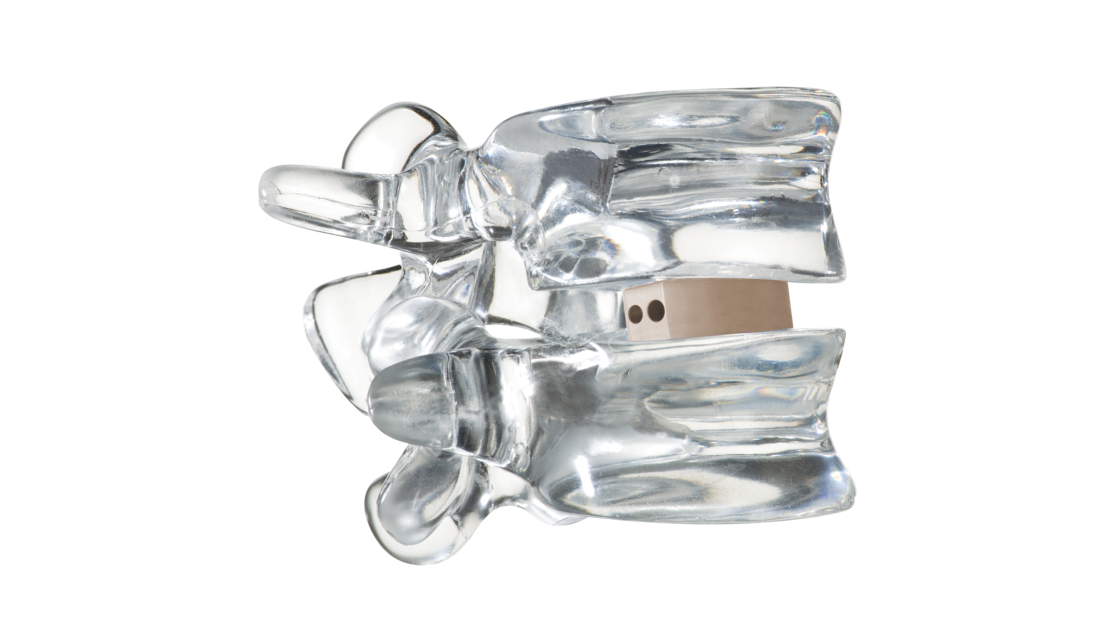 © ulrich medical. All rights reserved. Use, reproduction or transfer without express authorization is not permitted.