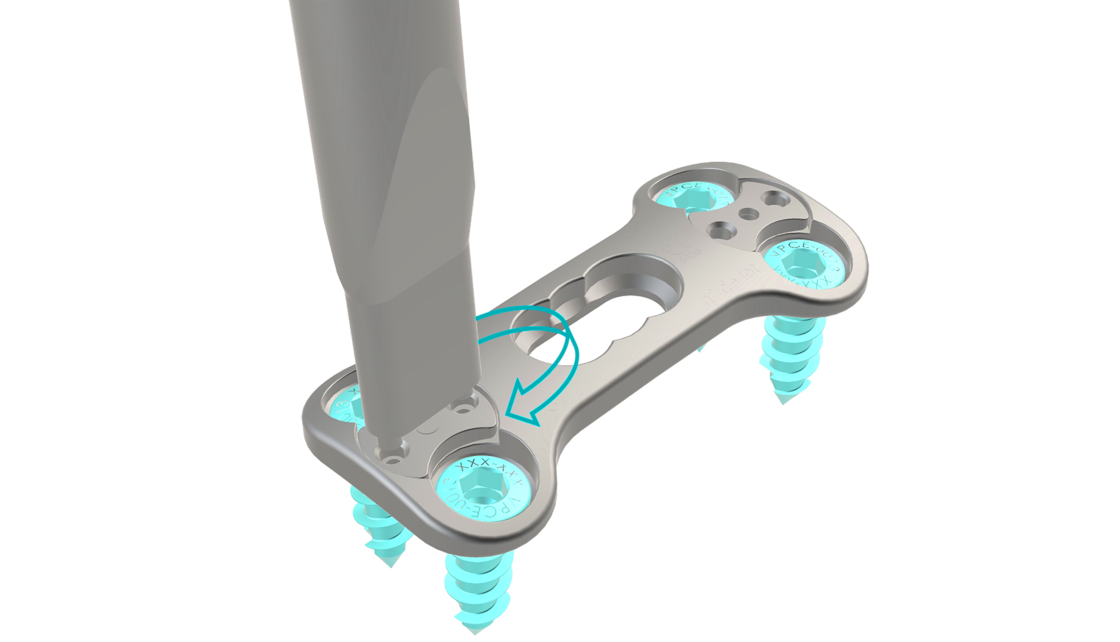 © ulrich medical. All rights reserved. Use, reproduction or transfer without express authorization is not permitted.