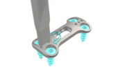 © ulrich medical. All rights reserved. Use, reproduction or transfer without express authorization is not permitted.