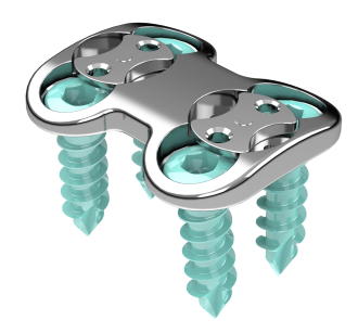 © ulrich medical. All rights reserved. Use, reproduction or transfer without express authorization is not permitted.