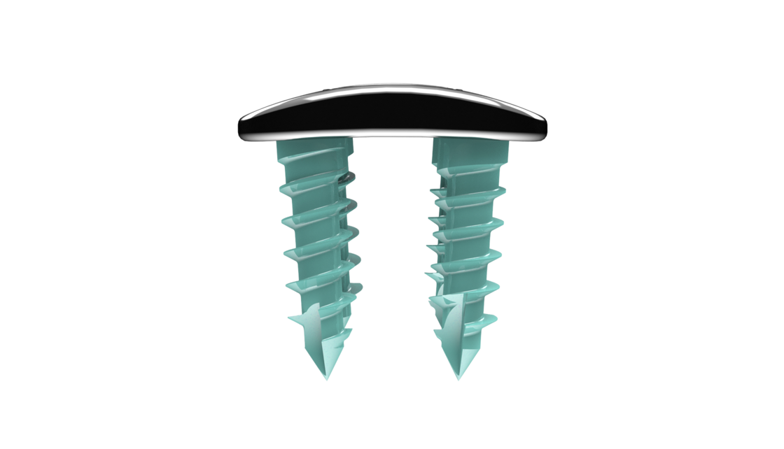 © ulrich medical. All rights reserved. Use, reproduction or transfer without express authorization is not permitted.