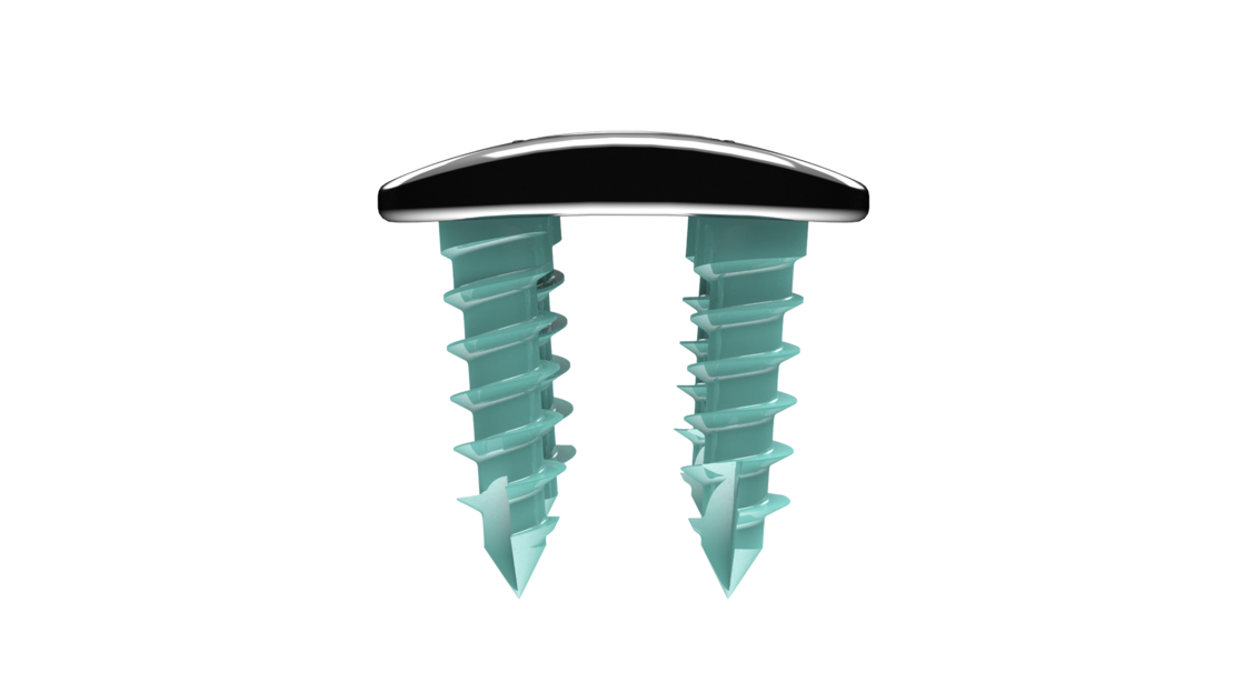 © Ulrich Medical. Todos los derechos reservados. Queda prohibido el uso, la reproducción o la distribución sin autorización expresa.