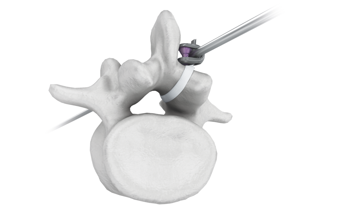 © 2025 ulrich medical. Alle Rechte vorbehalten. Die Verwendung, Vervielfältigung oder Weitergabe ohne ausdrückliche Genehmigung ist nicht gestattet.