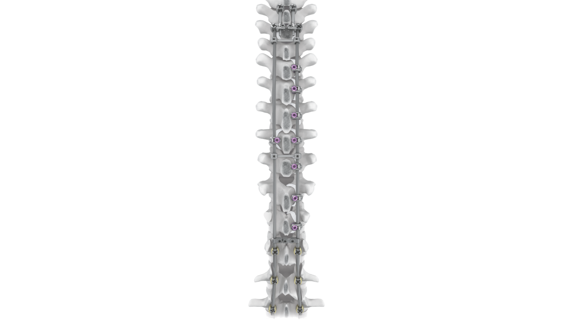 © 2025 ulrich medical. Alle Rechte vorbehalten. Die Verwendung, Vervielfältigung oder Weitergabe ohne ausdrückliche Genehmigung ist nicht gestattet.