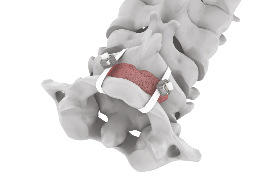 © 2025 ulrich medical. Alle Rechte vorbehalten. Die Verwendung, Vervielfältigung oder Weitergabe ohne ausdrückliche Genehmigung ist nicht gestattet.