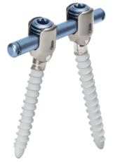 Übersichtsbild des Stab-Schrauben-Systems für die dynamische Stabilisierung der Wirbelsäule cosmicMIA von ulrich medical  | © 2025 ulrich medical. Alle Rechte vorbehalten. Die Verwendung, Vervielfältigung oder Weitergabe ohne ausdrückliche Genehmigung ist nicht gestattet.