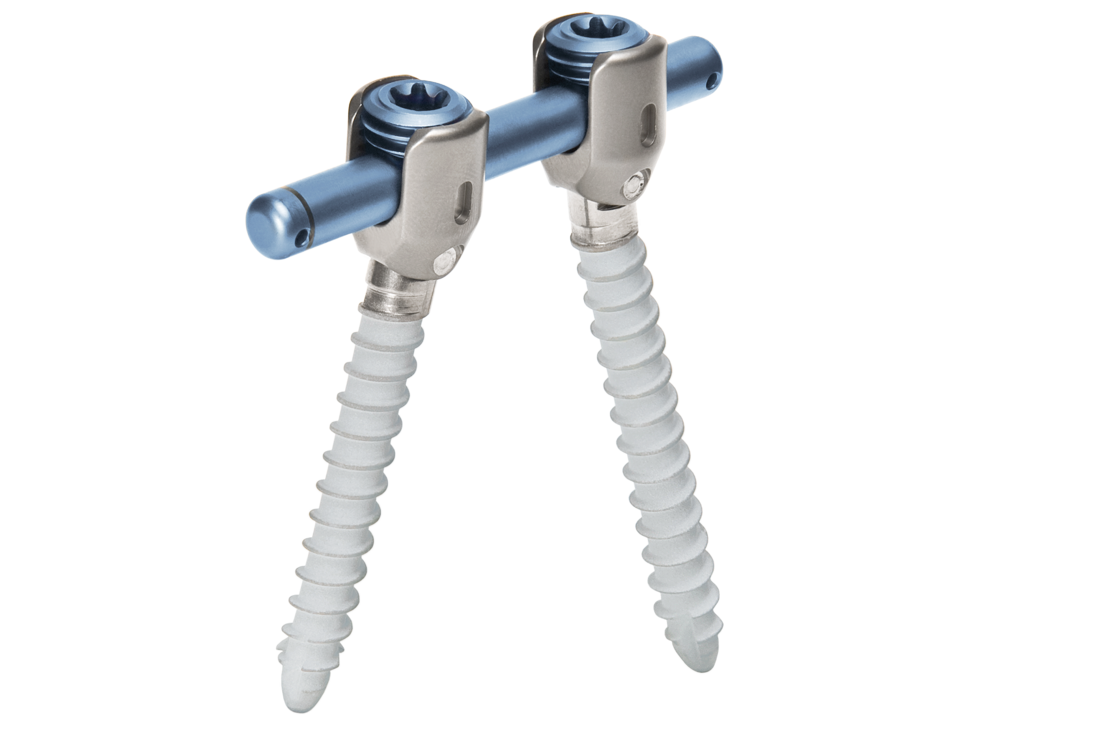Imagen general del sistema de varilla-tornillo para la estabilización dinámica de la columna vertebral cosmicMIA de ulrich medical  | © Ulrich Medical. Todos los derechos reservados. Queda prohibido el uso, la reproducción o la distribución sin autorización expresa.