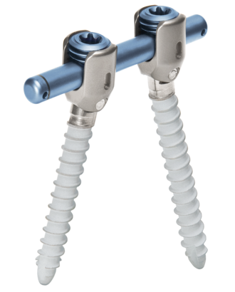 Imagen general del sistema de varilla-tornillo para la estabilización dinámica de la columna vertebral cosmicMIA de ulrich medical  | © Ulrich Medical. Todos los derechos reservados. Queda prohibido el uso, la reproducción o la distribución sin autorización expresa.