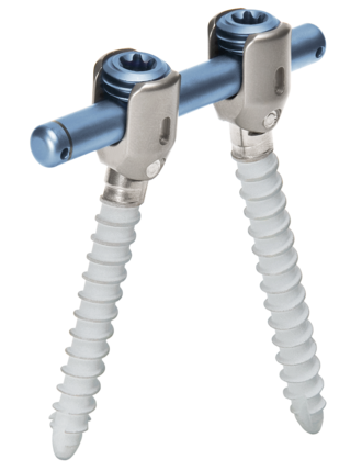 Imagen general del sistema de varilla-tornillo para la estabilización dinámica de la columna vertebral cosmicMIA de ulrich medical  | © Ulrich Medical. Todos los derechos reservados. Queda prohibido el uso, la reproducción o la distribución sin autorización expresa.