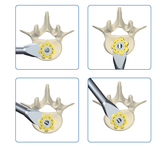 © ulrich medical. Tous droits réservés. L'utilisation, la reproduction ou la transmission sans autorisation expresse est interdite.