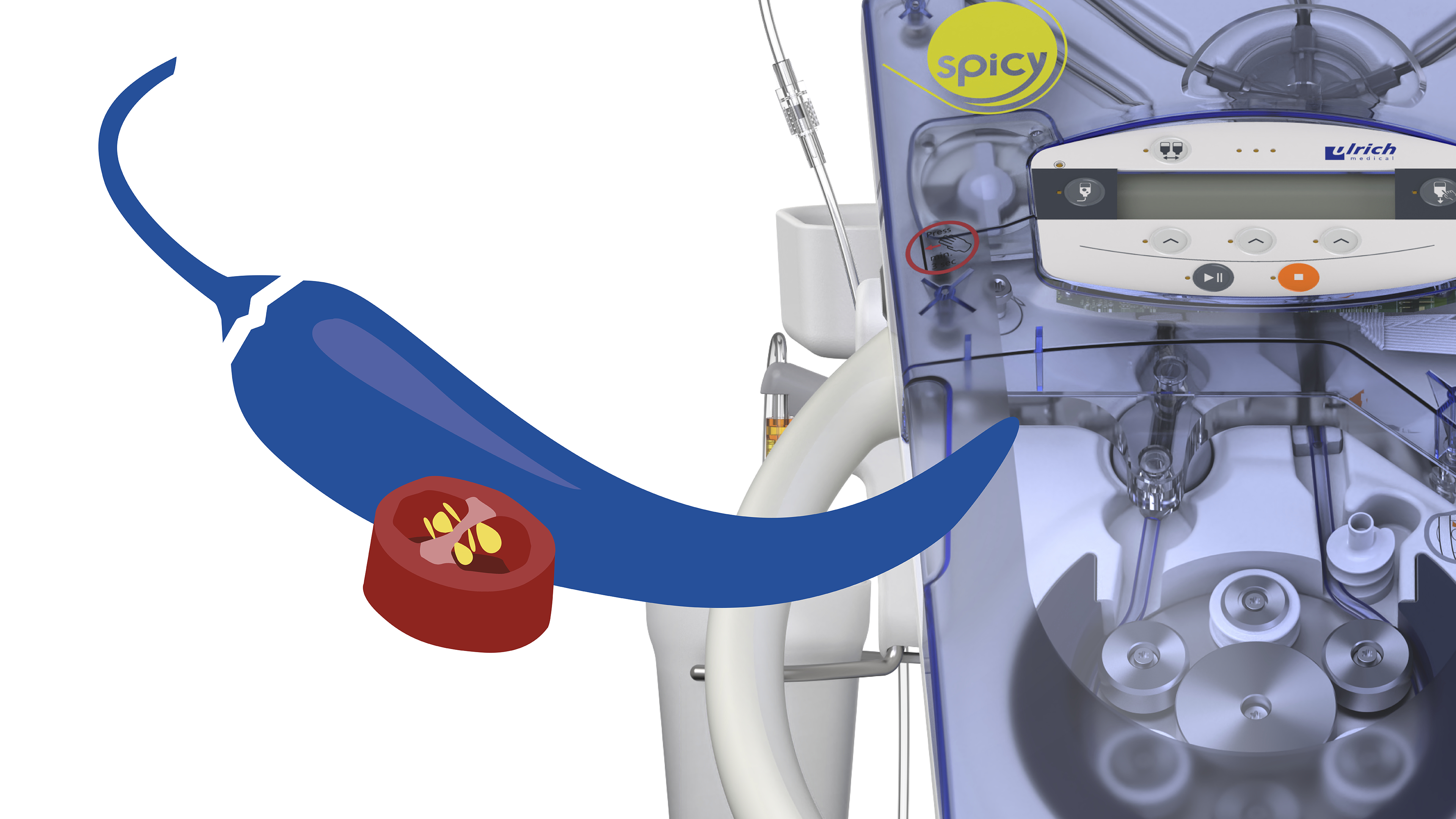© ulrich medical. All rights reserved. Use, reproduction or transfer without express authorization is not permitted.