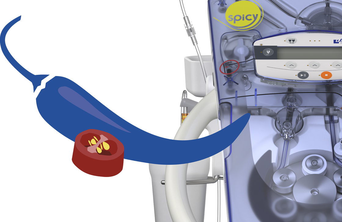 © ulrich medical. Tous droits réservés. L'utilisation, la reproduction ou la transmission sans autorisation expresse est interdite.
