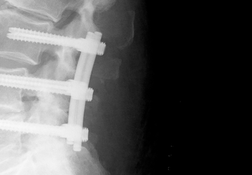 © Ulrich Medical. Todos los derechos reservados. Queda prohibido el uso, la reproducción o la distribución sin autorización expresa.