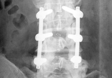© Ulrich Medical. Todos los derechos reservados. Queda prohibido el uso, la reproducción o la distribución sin autorización expresa.