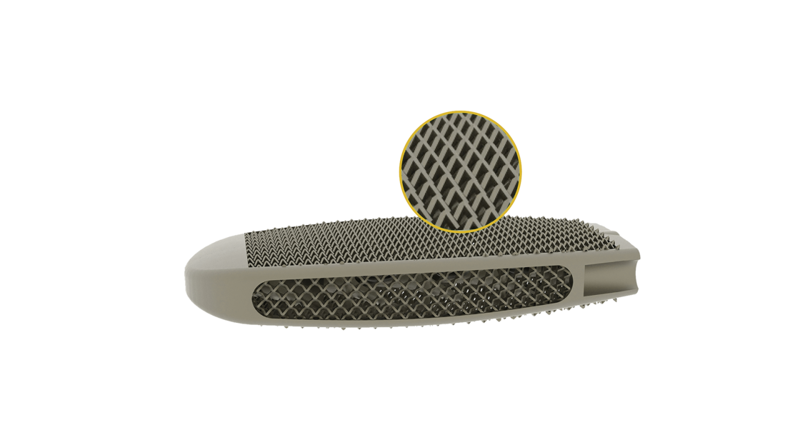 © 2025 ulrich medical. Alle Rechte vorbehalten. Die Verwendung, Vervielfältigung oder Weitergabe ohne ausdrückliche Genehmigung ist nicht gestattet.
