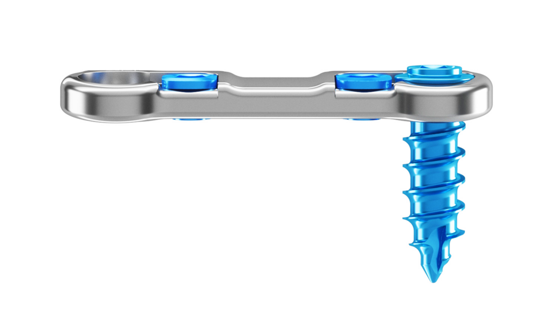 Representación de la inclinación craneal/caudal de los tornillos del sistema de placa cervical Artus de ulrich medical. | © Ulrich Medical. Todos los derechos reservados. Queda prohibido el uso, la reproducción o la distribución sin autorización expresa.