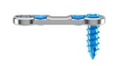 Representación de la inclinación craneal/caudal de los tornillos del sistema de placa cervical Artus de ulrich medical. | © Ulrich Medical. Todos los derechos reservados. Queda prohibido el uso, la reproducción o la distribución sin autorización expresa.