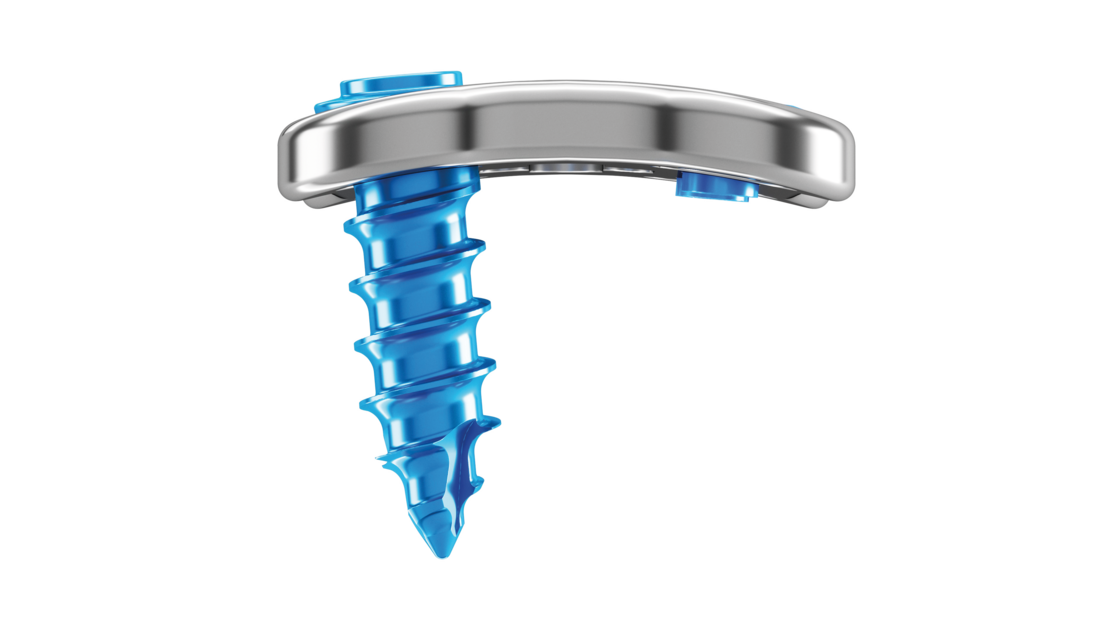 Representación de la inclinación lateral/medial de los tornillos del sistema de placa cervical Artus de ulrich medical. | © Ulrich Medical. Todos los derechos reservados. Queda prohibido el uso, la reproducción o la distribución sin autorización expresa.