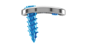 Representación de la inclinación lateral/medial de los tornillos del sistema de placa cervical Artus de ulrich medical. | © Ulrich Medical. Todos los derechos reservados. Queda prohibido el uso, la reproducción o la distribución sin autorización expresa.