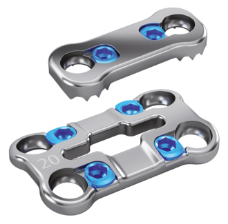 Darstellung der 1-Level Standardplatte und der 1-Level medialen Platte des zervikalen Plattensystems Artus von ulrich medical. | © 2025 ulrich medical. Alle Rechte vorbehalten. Die Verwendung, Vervielfältigung oder Weitergabe ohne ausdrückliche Genehmigung ist nicht gestattet.