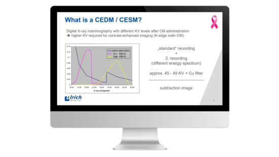© 2025 ulrich medical. Alle Rechte vorbehalten. Die Verwendung, Vervielfältigung oder Weitergabe ohne ausdrückliche Genehmigung ist nicht gestattet.