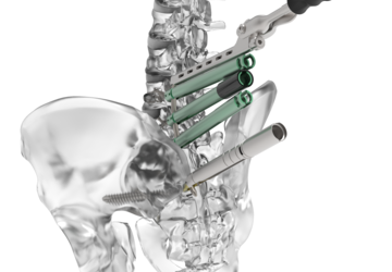 © ulrich medical. Tous droits réservés. L'utilisation, la reproduction ou la transmission sans autorisation expresse est interdite. © ulrich medical. Tous droits réservés. L'utilisation, la reproduction ou la transmission sans autorisation expresse est interdite.