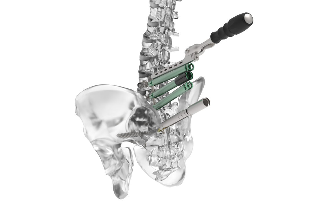 © 2025 ulrich medical. Alle Rechte vorbehalten. Die Verwendung, Vervielfältigung oder Weitergabe ohne ausdrückliche Genehmigung ist nicht gestattet.