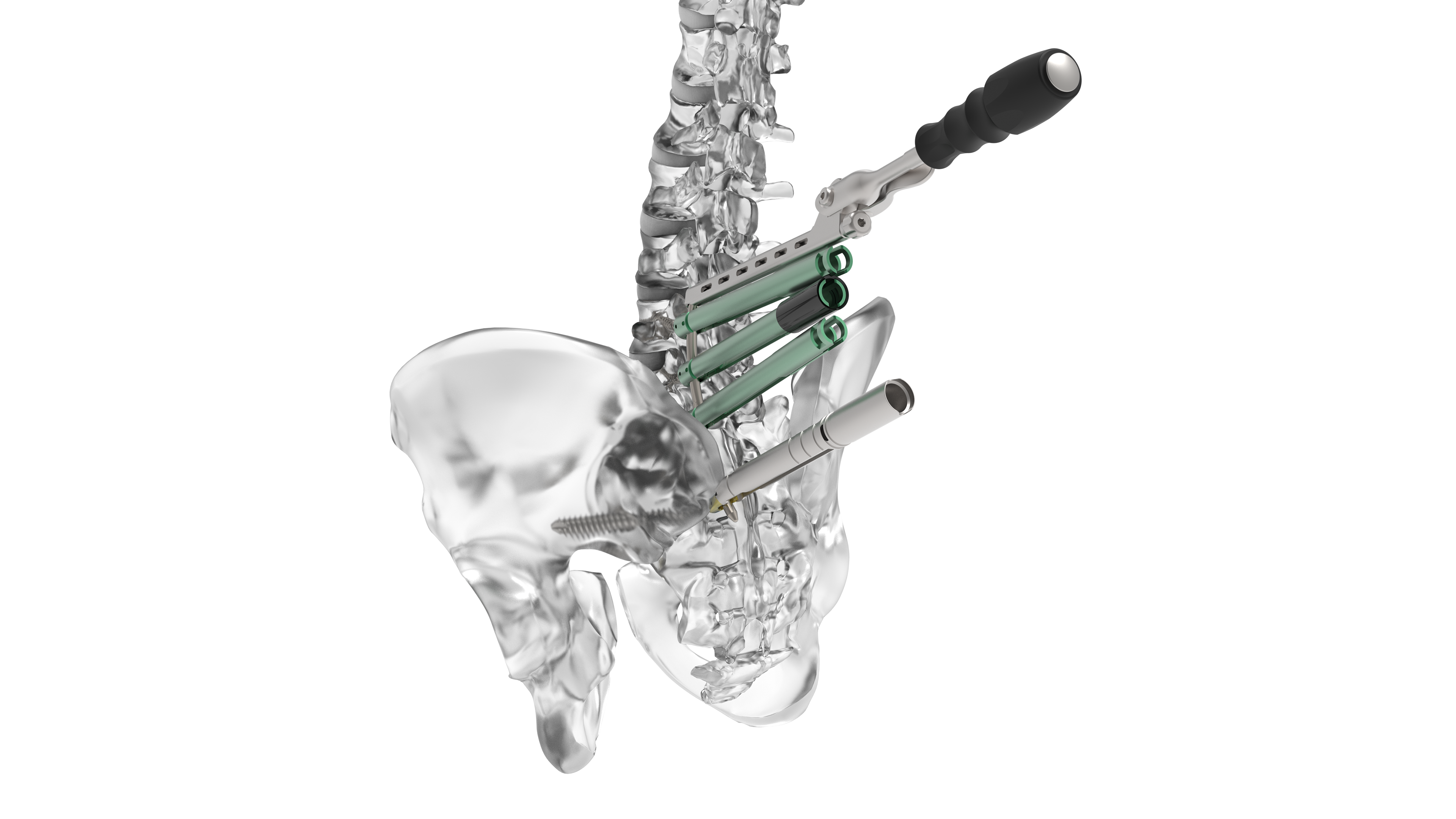 © Ulrich Medical. Todos los derechos reservados. Queda prohibido el uso, la reproducción o la distribución sin autorización expresa.