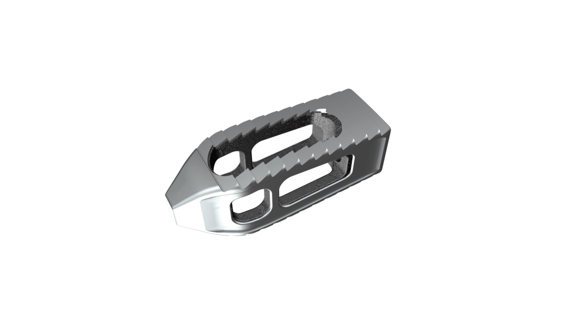 © 2025 ulrich medical. Alle Rechte vorbehalten. Die Verwendung, Vervielfältigung oder Weitergabe ohne ausdrückliche Genehmigung ist nicht gestattet.