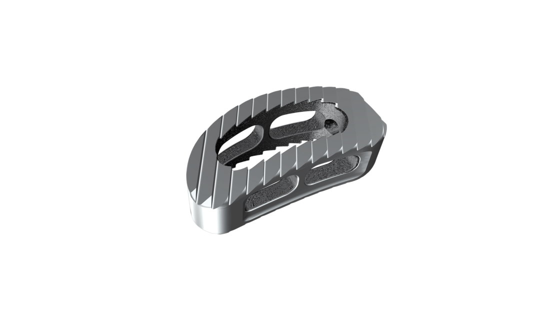 © ulrich medical. All rights reserved. Use, reproduction or transfer without express authorization is not permitted.