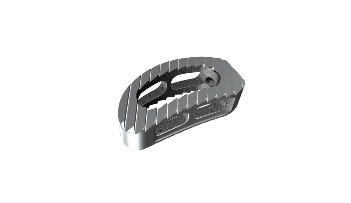 © 2025 ulrich medical. Alle Rechte vorbehalten. Die Verwendung, Vervielfältigung oder Weitergabe ohne ausdrückliche Genehmigung ist nicht gestattet.