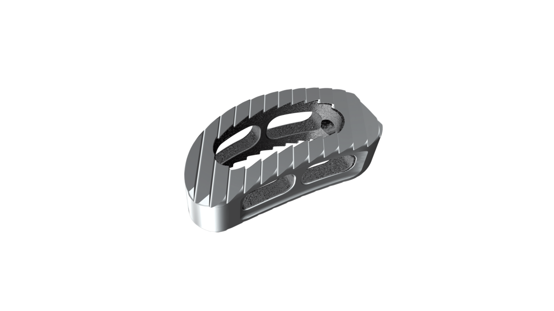 © ulrich medical. Tous droits réservés. L'utilisation, la reproduction ou la transmission sans autorisation expresse est interdite.