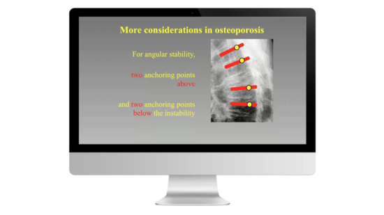 © 2025 ulrich medical. Alle Rechte vorbehalten. Die Verwendung, Vervielfältigung oder Weitergabe ohne ausdrückliche Genehmigung ist nicht gestattet.
