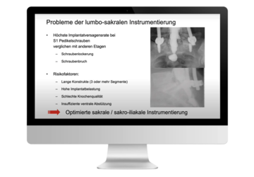 © 2025 ulrich medical. Alle Rechte vorbehalten. Die Verwendung, Vervielfältigung oder Weitergabe ohne ausdrückliche Genehmigung ist nicht gestattet.