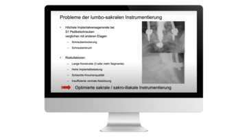 © 2025 ulrich medical. Alle Rechte vorbehalten. Die Verwendung, Vervielfältigung oder Weitergabe ohne ausdrückliche Genehmigung ist nicht gestattet.