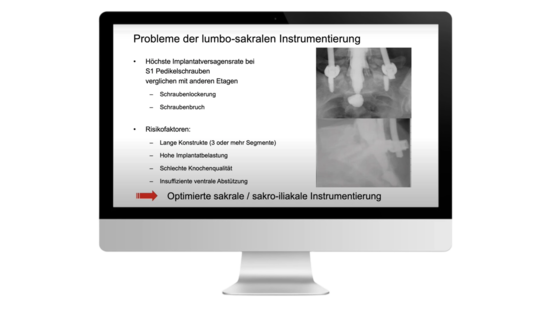 © 2025 ulrich medical. Alle Rechte vorbehalten. Die Verwendung, Vervielfältigung oder Weitergabe ohne ausdrückliche Genehmigung ist nicht gestattet.